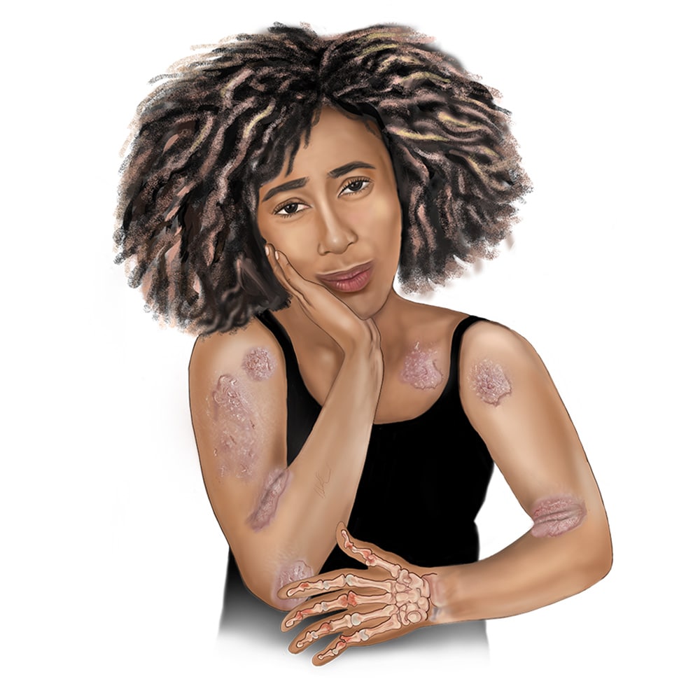 Black woman medical illustration
